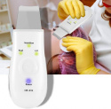 Bezprzewodowy peeling ultradźwiękowy do twarzy Bezprzewodowy peeling ultradźwiękowy do twarzy