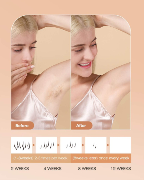 DEPILATOR IPL INNZA DO CIAŁA BIKINI NÓG TWARZY DEPILATOR IPL INNZA DO CIAŁA BIKINI NÓG TWARZY